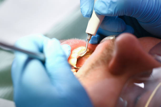 Best Emergency Treatment for Dental Infections or Abscesses in White Bear Lake, MN