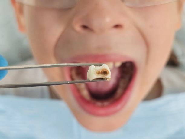 Best Emergency Orthodontic Services in White Bear Lake, MN