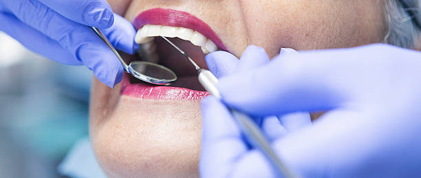 Best Urgent Care for Lost Fillings or Crowns in White Bear Lake, MN