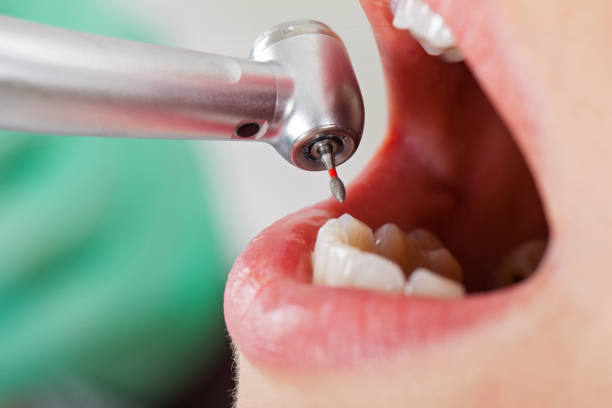Best Emergency Denture Repair in White Bear Lake, MN